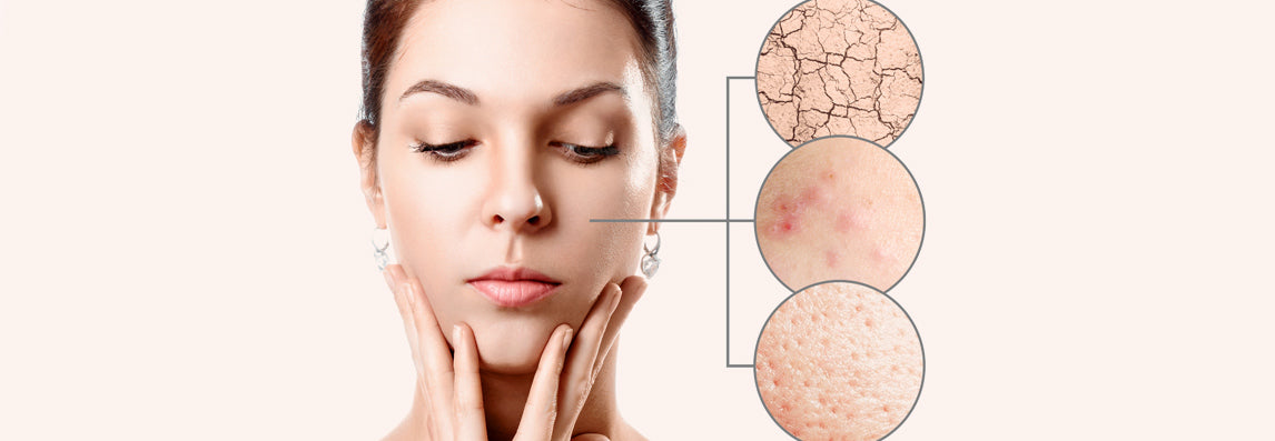 Quel est mon véritable type de peau ?